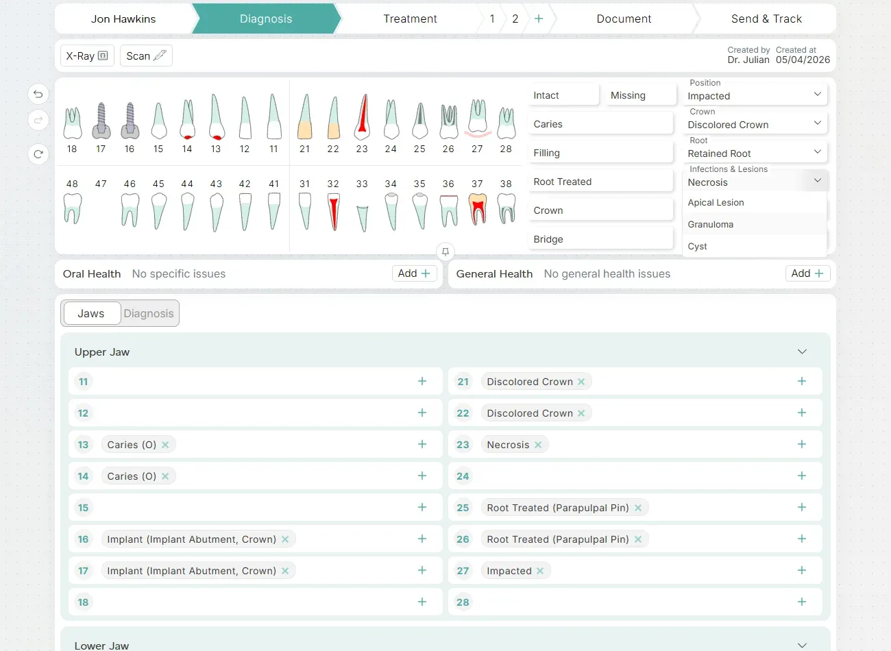 Plandentic diagnosis view on an interactive tooth chart